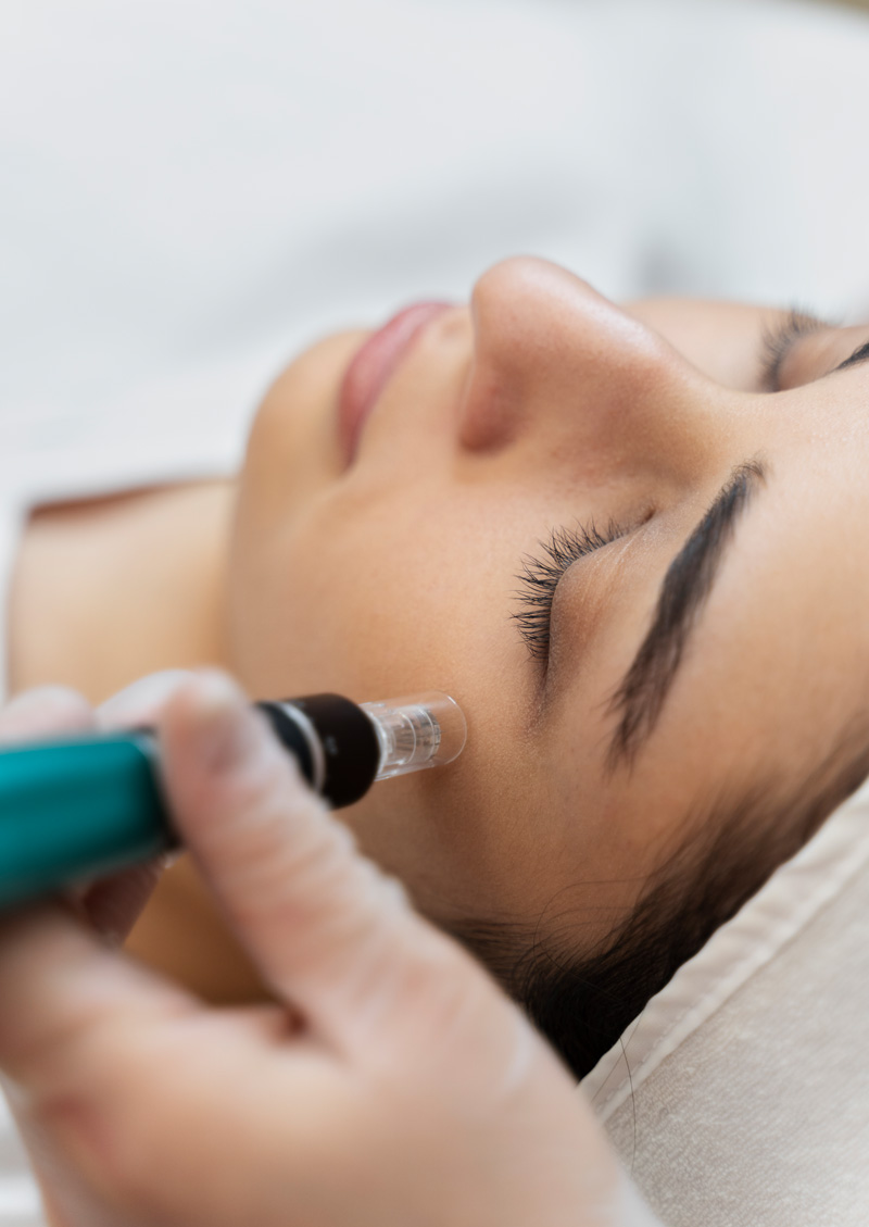 salonamber-microdermabrasie1